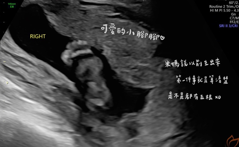 懷孕紀錄｜22weeks－高層次超音波